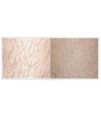 HUILE D’ŒUFS DE FOURMIS - Epilation