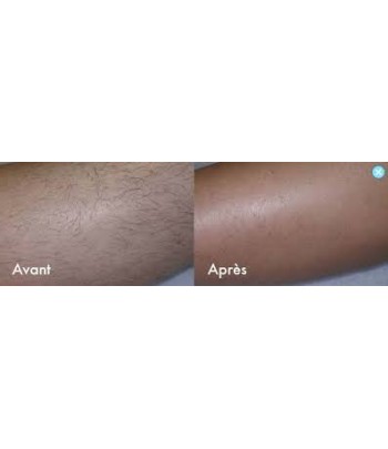 HUILE D’ŒUFS DE FOURMIS - Epilation